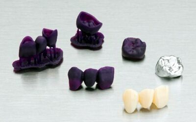 Prensa e fundição odontológica a partir de modelos impressos em 3D Formlabs