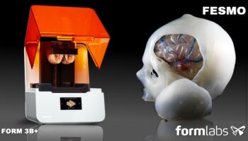 Form 3B Plus | Impressão 3D de Aneurismas Cerebrais de forma inovadora para o tratamento