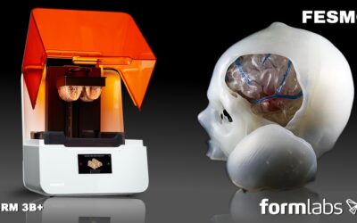 Form 3B+ | Impressão 3D de Aneurismas Cerebrais de forma inovadora para o tratamento