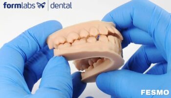 Formlabs Dental | Dentaduras Digitais com a Impressora 3D Form 3B+