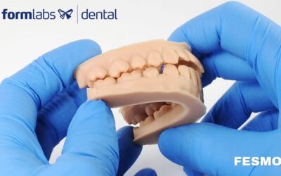 Formlabs Dental | Dentaduras Digitais com a Impressora 3D Form 3B+
