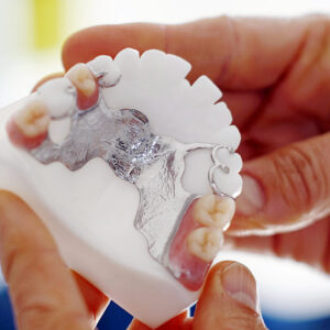 GPAINNOVA | Acabamento de superfícies Dlyte para a indústria odontológica