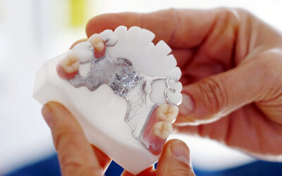 GPAINNOVA | Acabamento de superfícies Dlyte para a indústria odontológica