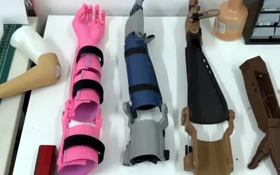 Projeto Mao3D | Alunos da Unifesp desenvolvem Próteses Personalizadas com apoio da Impressão 3D